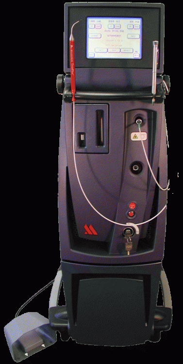 Millennium Periolase MVP-7 Laser- minimally invasive treatment for periodontal disease